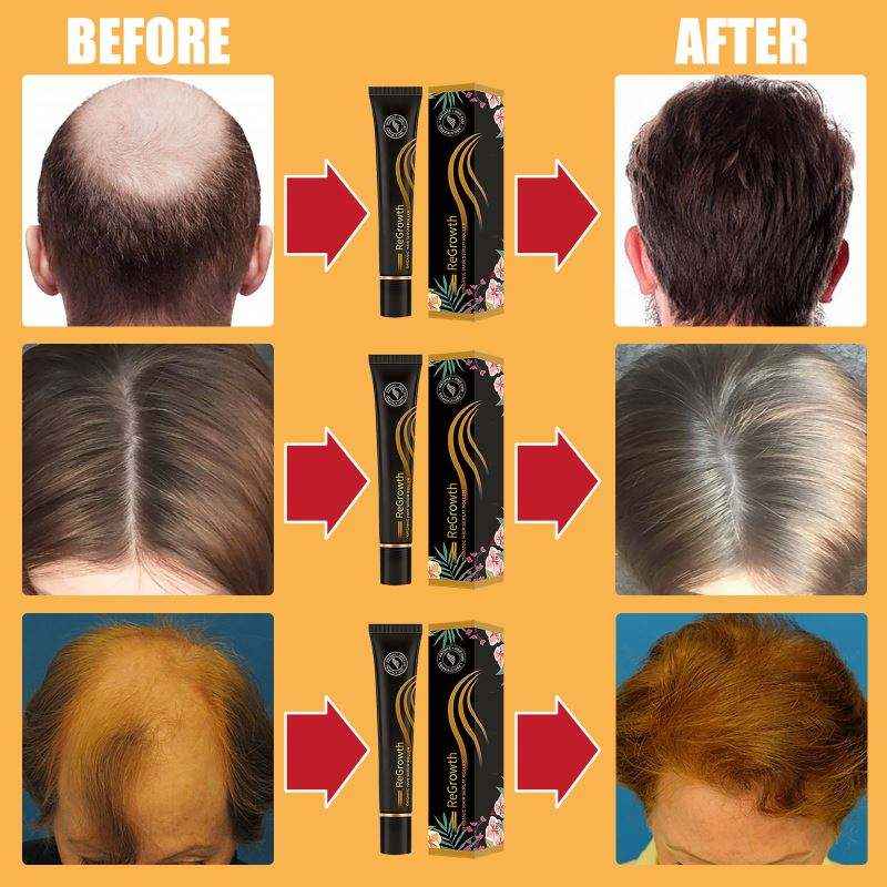 Organic Hair Growth Serum